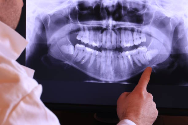 Best Emergency Root Canal Therapy in East Brooklyn, CT
