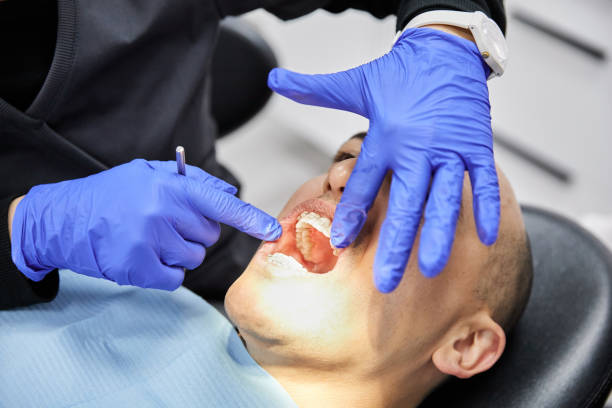 Best Dental Abscess Treatment in East Brooklyn, CT